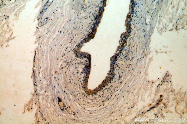 FRK Antibody in Immunohistochemistry (Paraffin) (IHC (P))