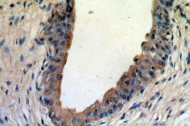 FRK Antibody in Immunohistochemistry (Paraffin) (IHC (P))