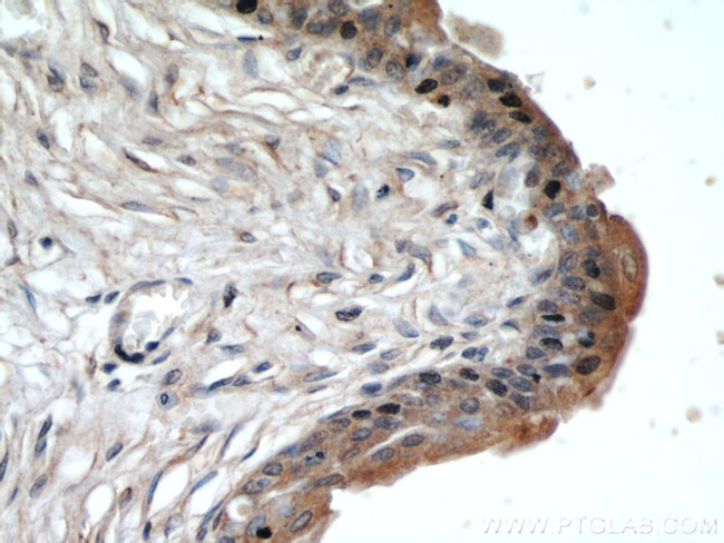 FRK Antibody in Immunohistochemistry (Paraffin) (IHC (P))