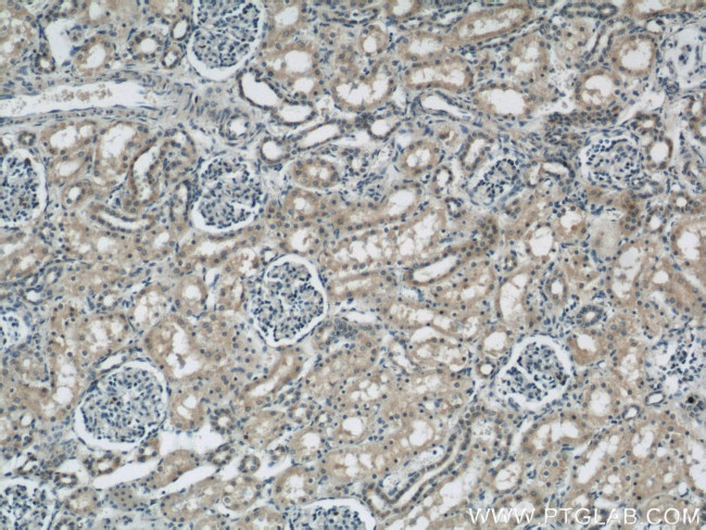 FRK Antibody in Immunohistochemistry (Paraffin) (IHC (P))