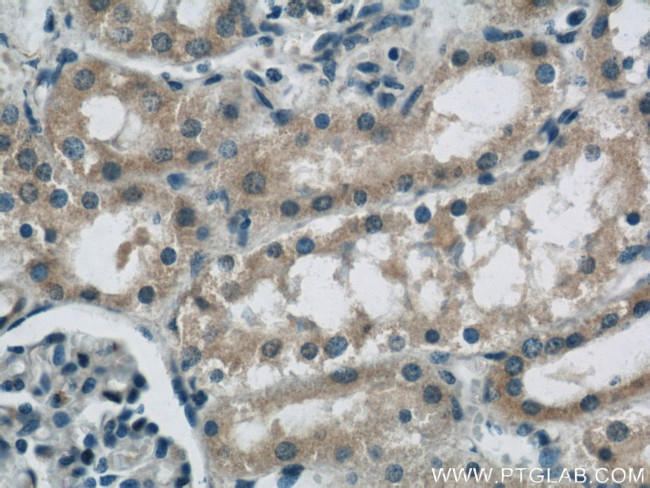 FRK Antibody in Immunohistochemistry (Paraffin) (IHC (P))