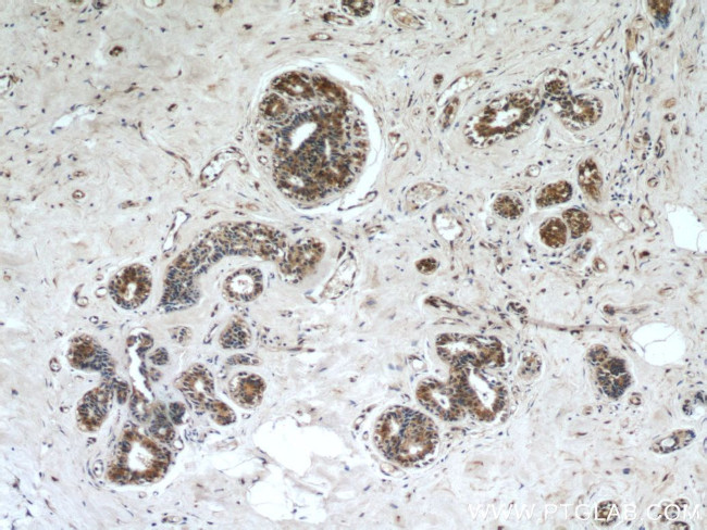 FRK Antibody in Immunohistochemistry (Paraffin) (IHC (P))