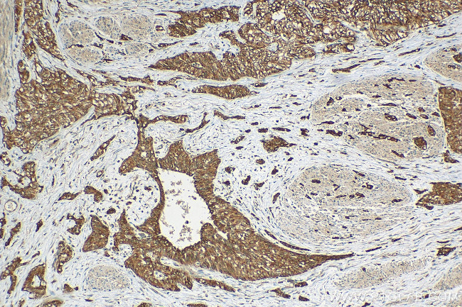 FRK Antibody in Immunohistochemistry (Paraffin) (IHC (P))