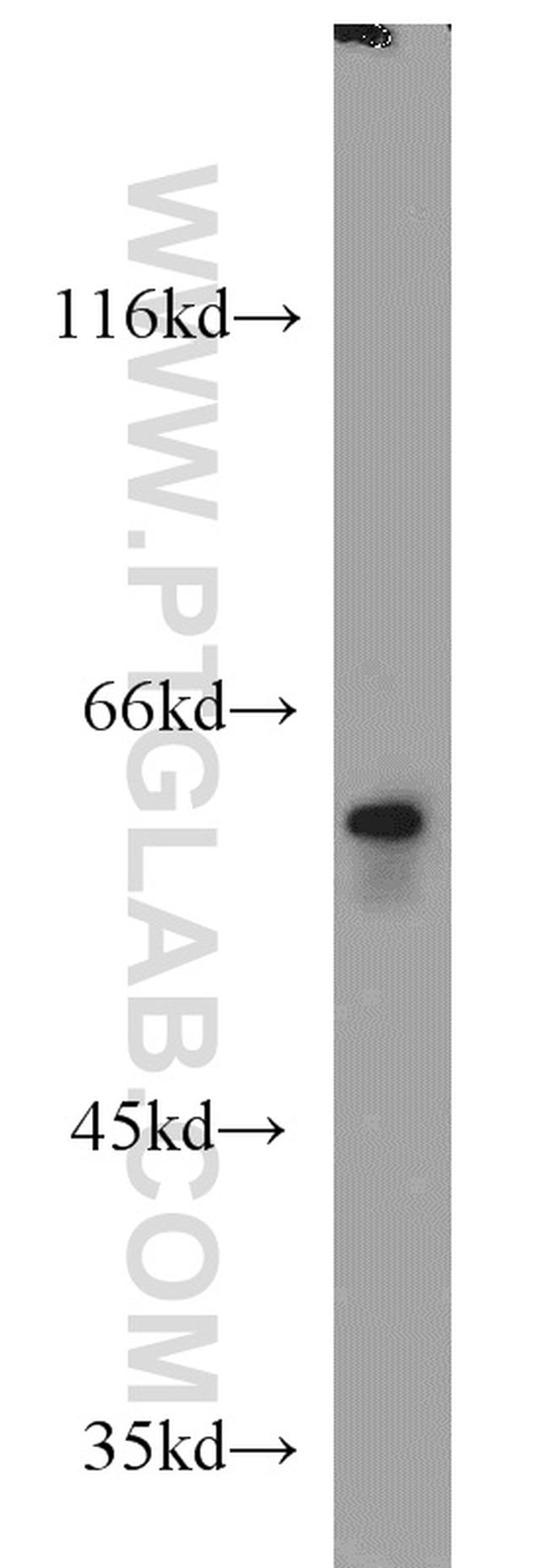 FRK Antibody in Western Blot (WB)