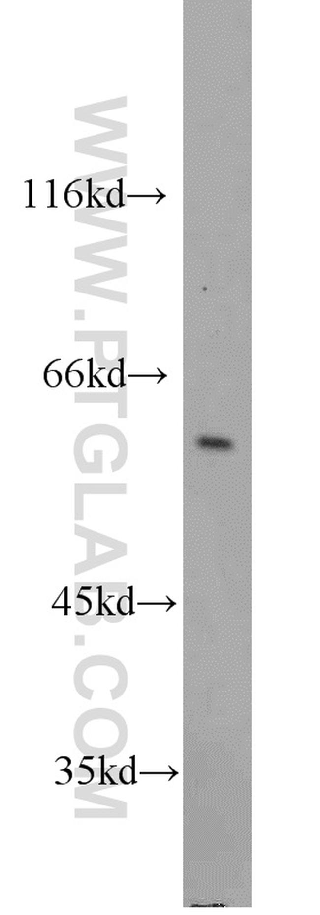 FRK Antibody in Western Blot (WB)