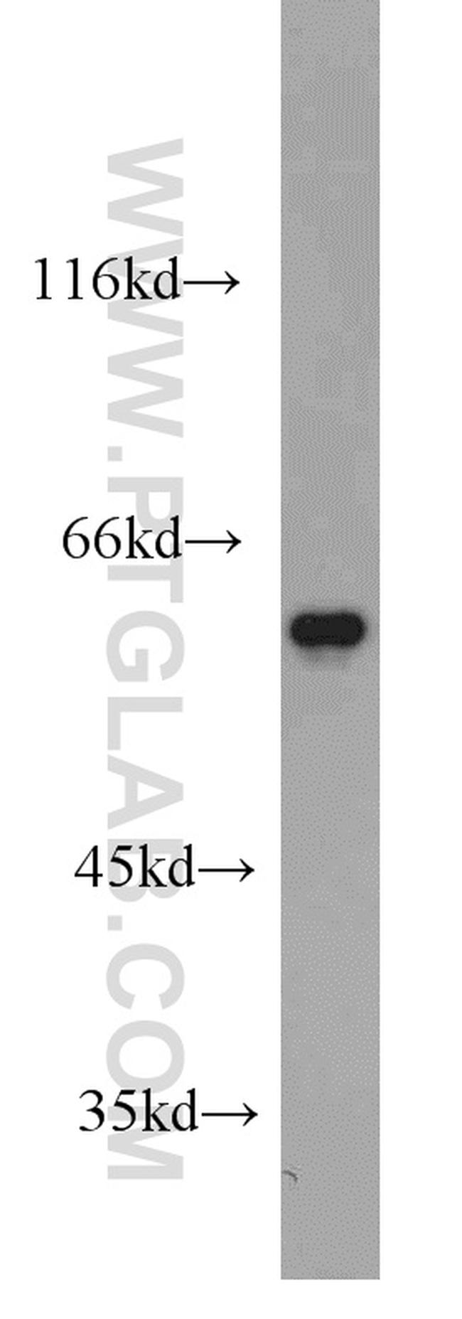 FRK Antibody in Western Blot (WB)