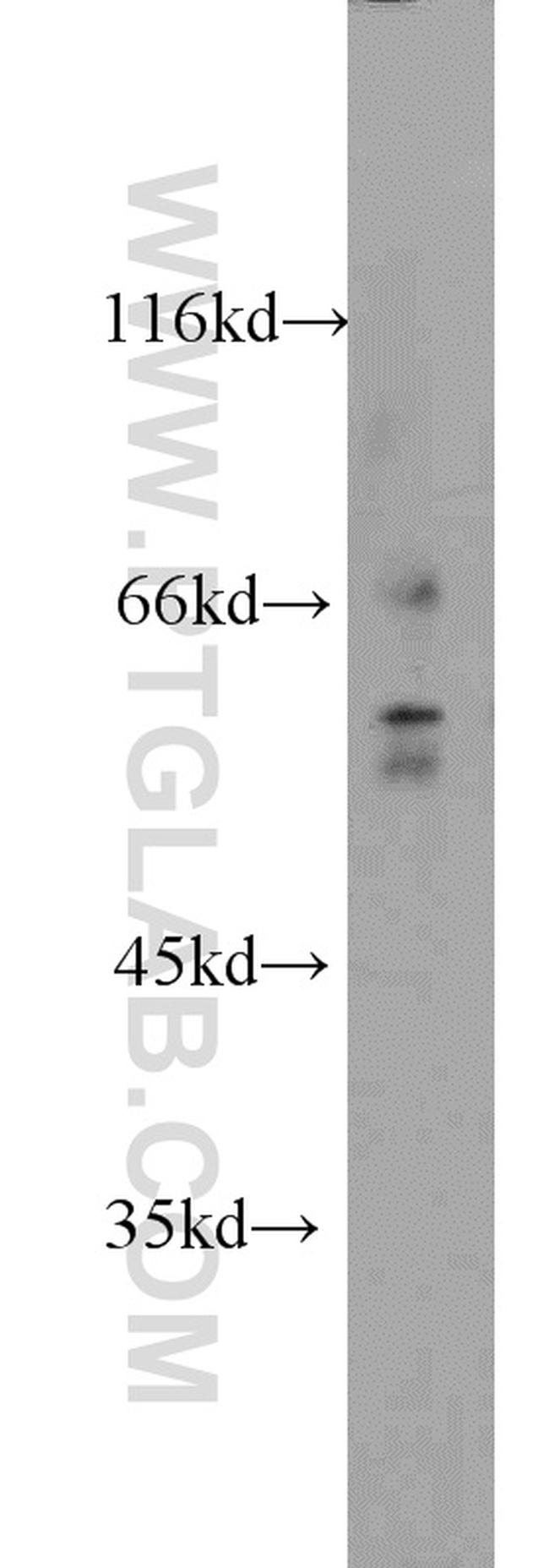 FRK Antibody in Western Blot (WB)