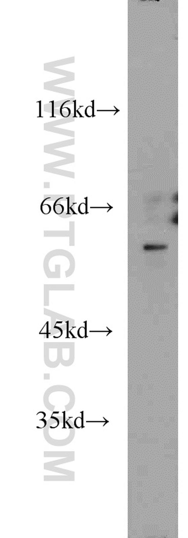 FRK Antibody in Western Blot (WB)