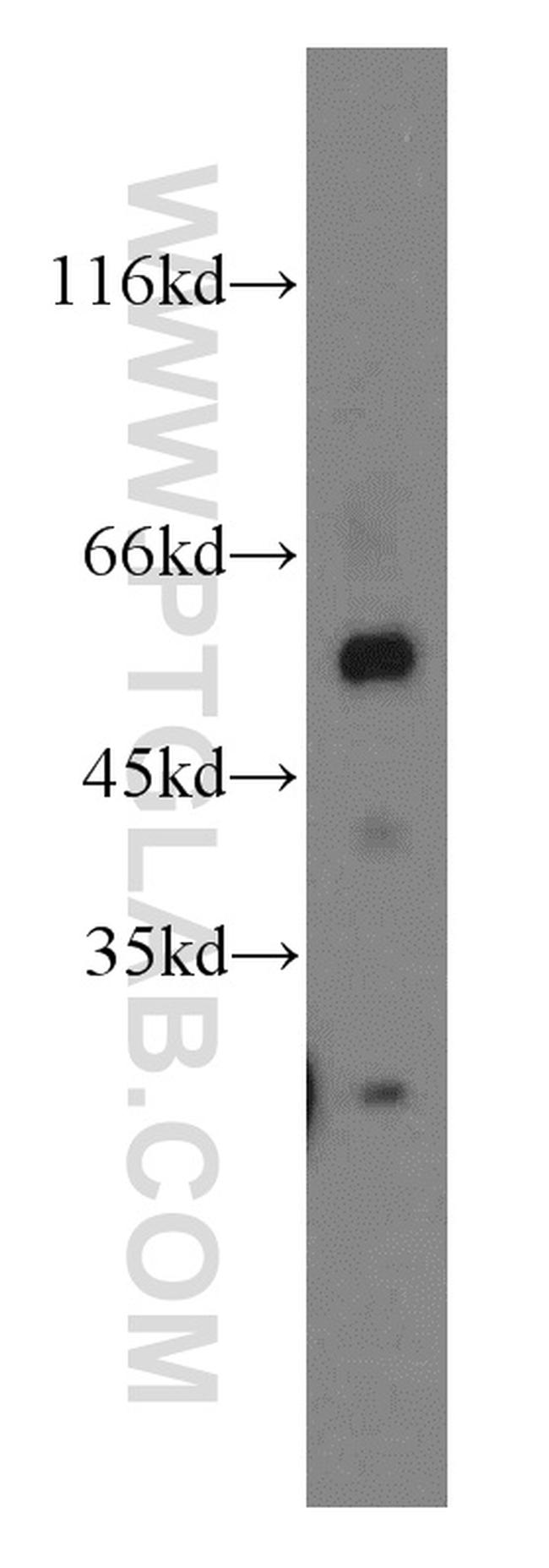 FRK Antibody in Western Blot (WB)