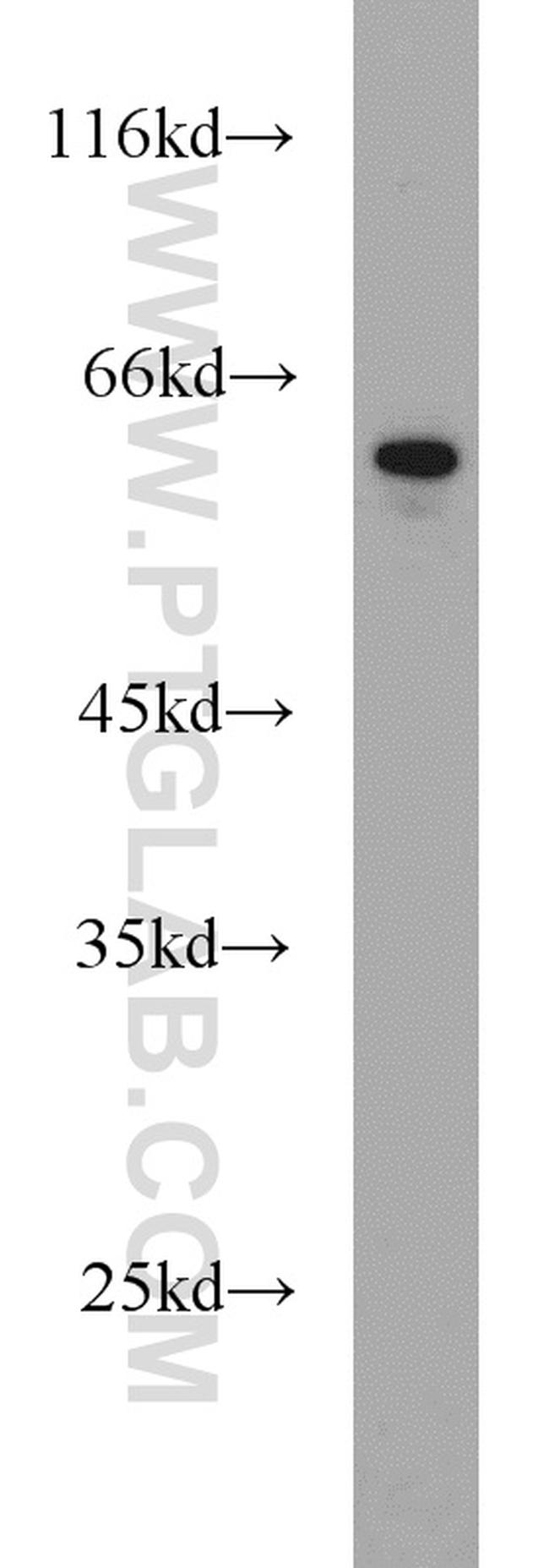 FRK Antibody in Western Blot (WB)