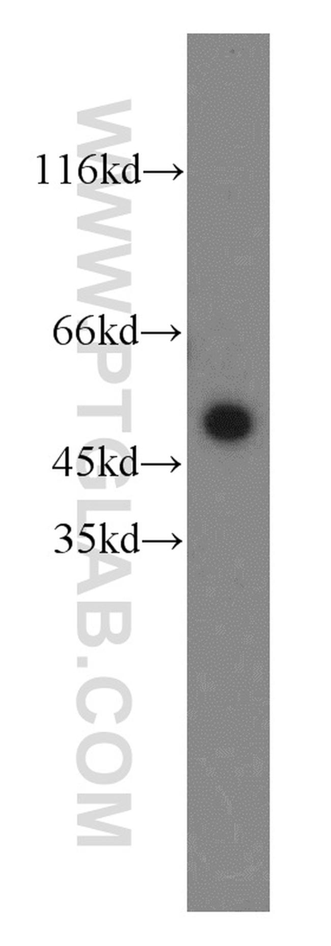 FRK Antibody in Western Blot (WB)