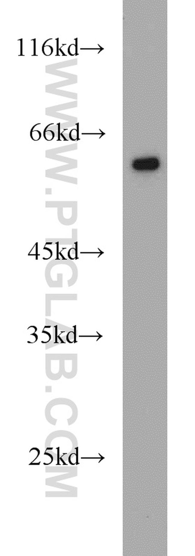 FRK Antibody in Western Blot (WB)