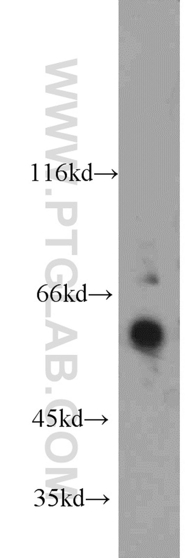 FRK Antibody in Western Blot (WB)