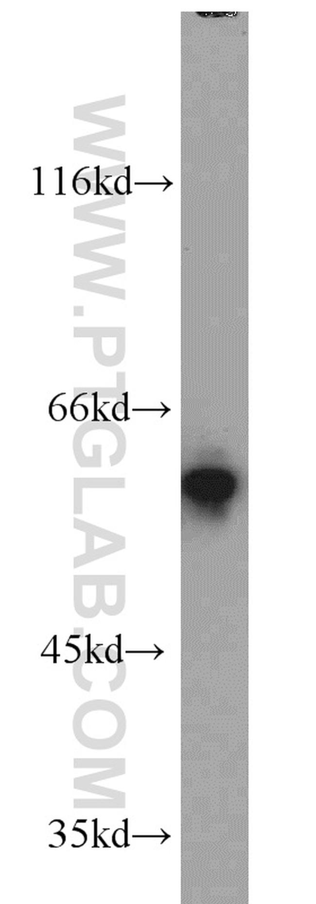 FRK Antibody in Western Blot (WB)