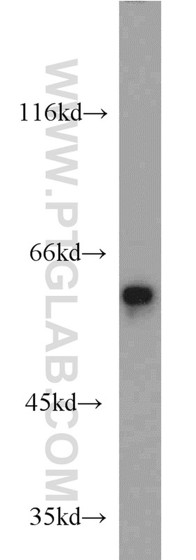 FRK Antibody in Western Blot (WB)