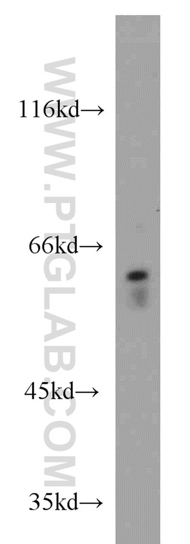 FRK Antibody in Western Blot (WB)