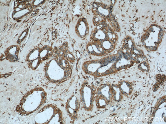 HTF9C Antibody in Immunohistochemistry (Paraffin) (IHC (P))