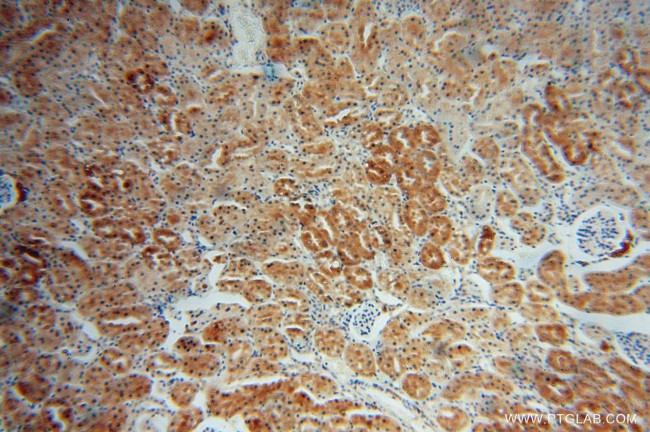 HTF9C Antibody in Immunohistochemistry (Paraffin) (IHC (P))