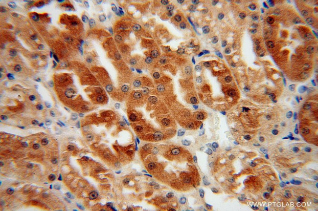 HTF9C Antibody in Immunohistochemistry (Paraffin) (IHC (P))