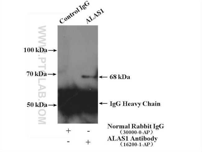 ALAS1 Antibody in Immunoprecipitation (IP)