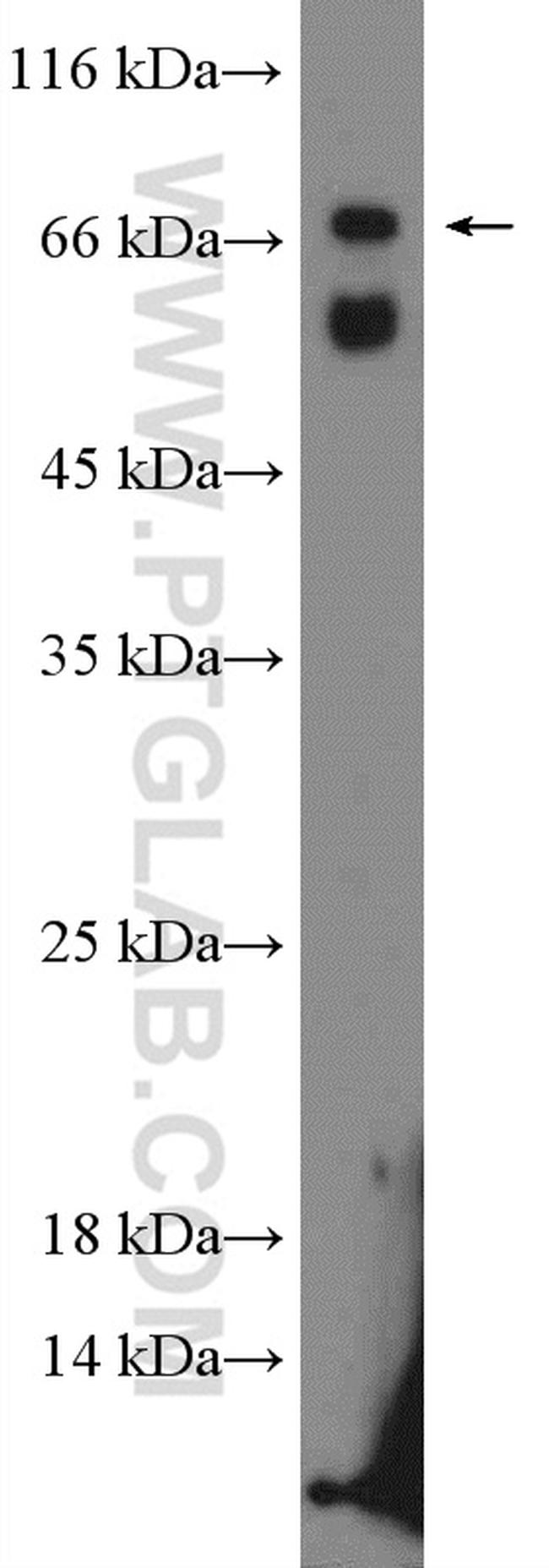 ALAS1 Antibody in Western Blot (WB)