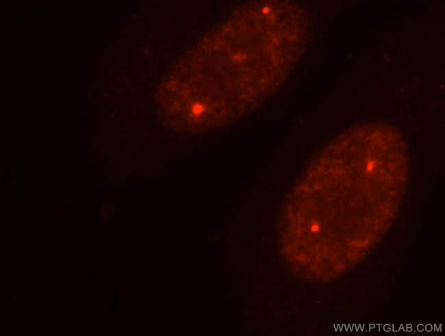 TOE1 Antibody in Immunocytochemistry (ICC/IF)