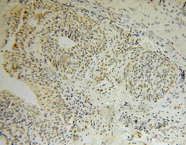 TOE1 Antibody in Immunohistochemistry (Paraffin) (IHC (P))