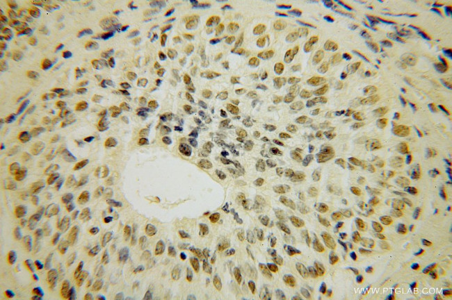 TOE1 Antibody in Immunohistochemistry (Paraffin) (IHC (P))