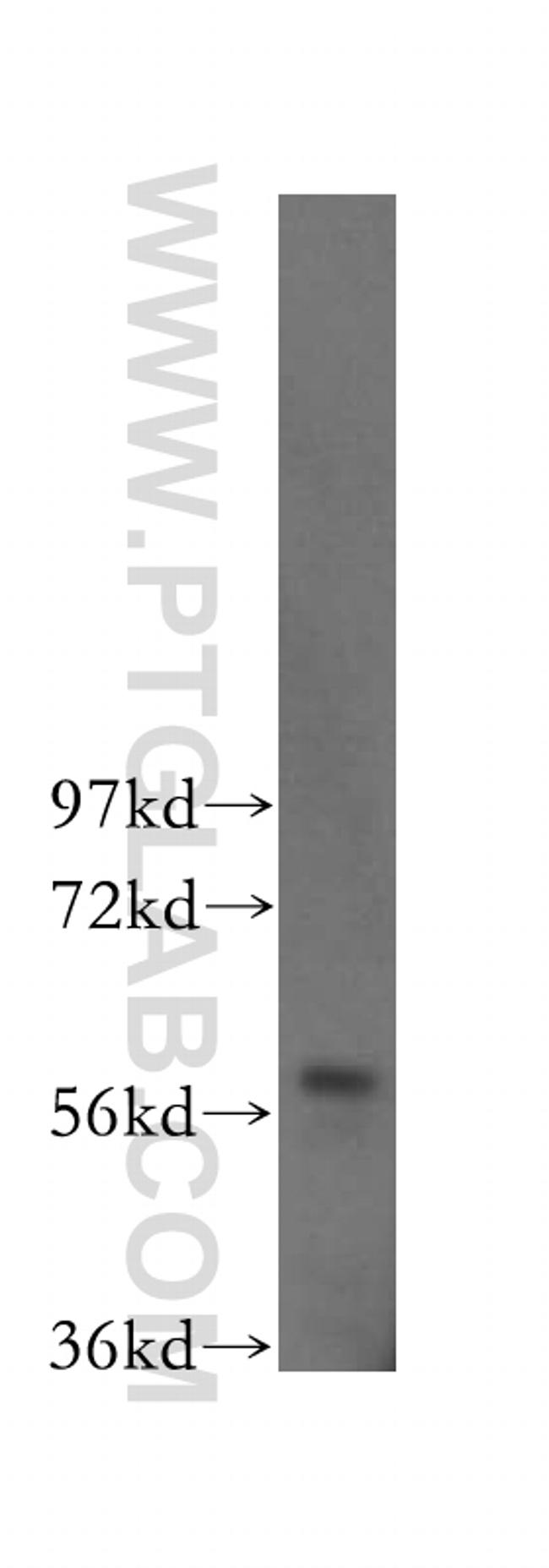 TOE1 Antibody in Western Blot (WB)