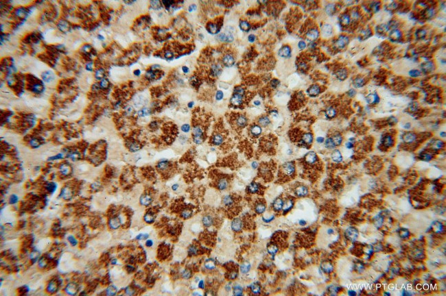 ACSS3 Antibody in Immunohistochemistry (Paraffin) (IHC (P))