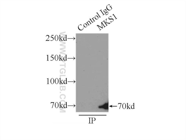 MKS1 Antibody in Immunoprecipitation (IP)