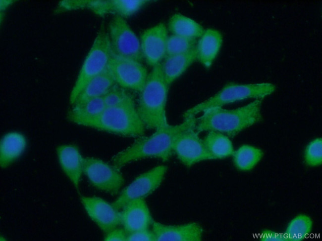 ASS1 Antibody in Immunocytochemistry (ICC/IF)