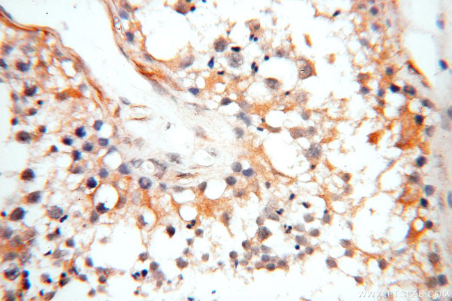 ASS1 Antibody in Immunohistochemistry (Paraffin) (IHC (P))