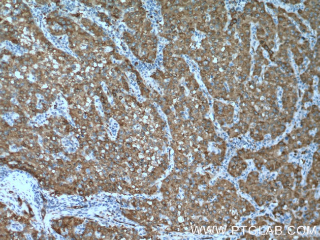 ASS1 Antibody in Immunohistochemistry (Paraffin) (IHC (P))