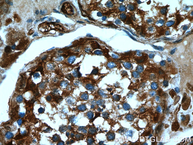 ASS1 Antibody in Immunohistochemistry (Paraffin) (IHC (P))