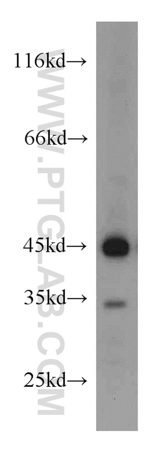 ASS1 Antibody in Western Blot (WB)