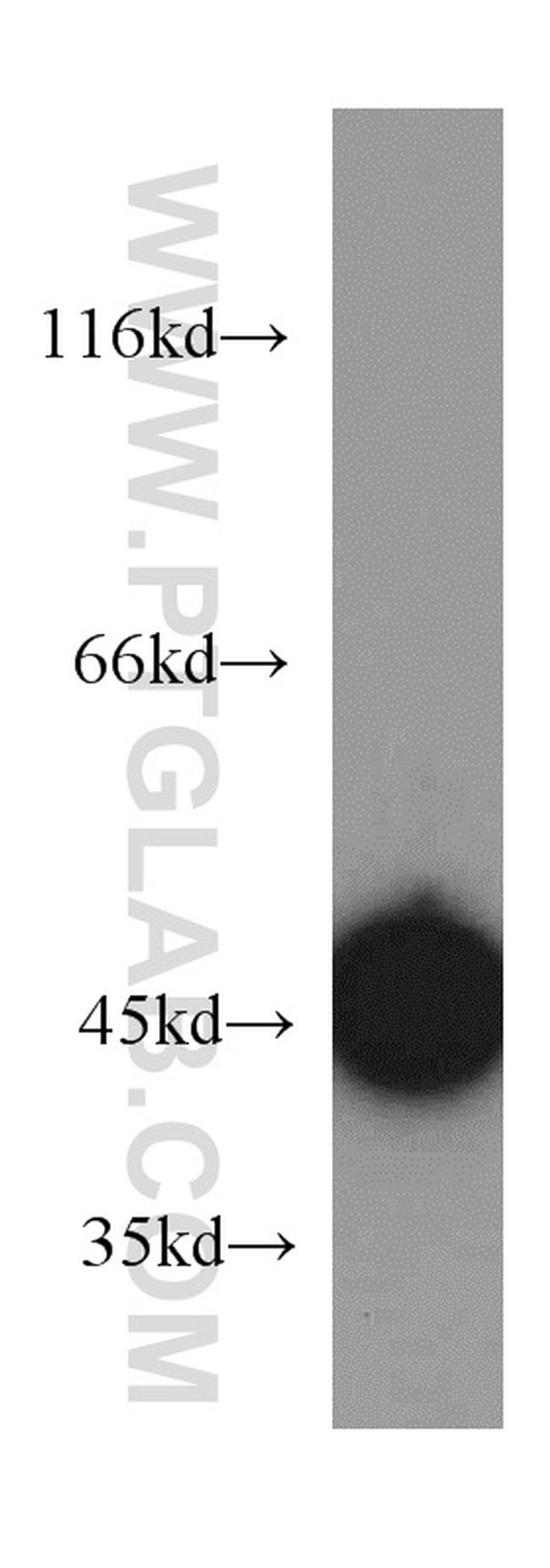 ASS1 Antibody in Western Blot (WB)