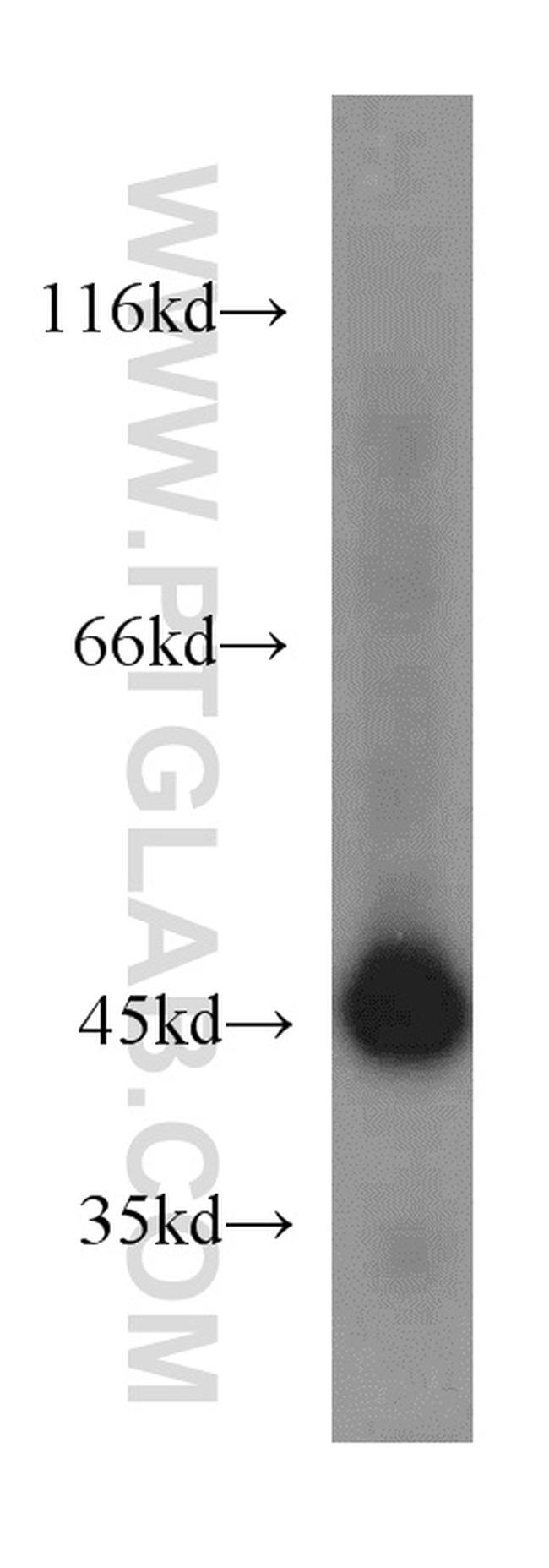 ASS1 Antibody in Western Blot (WB)