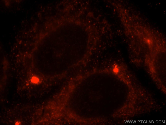 ACAT1 Antibody in Immunocytochemistry (ICC/IF)