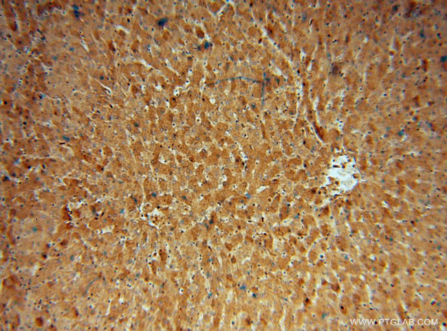 ACAT1 Antibody in Immunohistochemistry (Paraffin) (IHC (P))