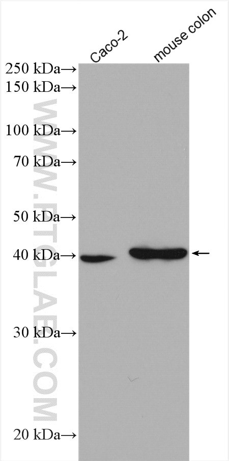 ACAT1 Antibody in Western Blot (WB)