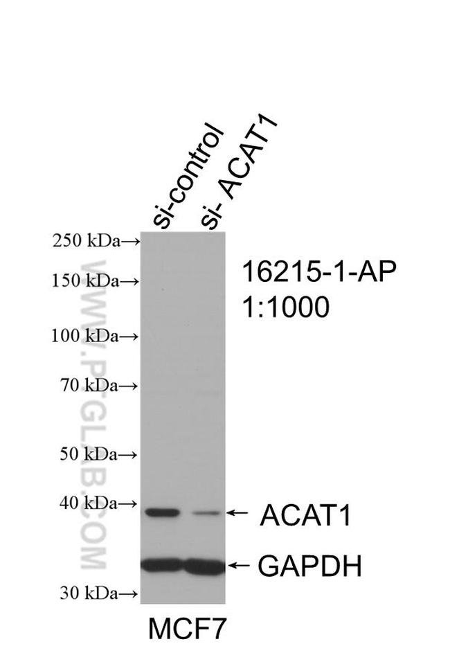 ACAT1 Antibody in Western Blot (WB)