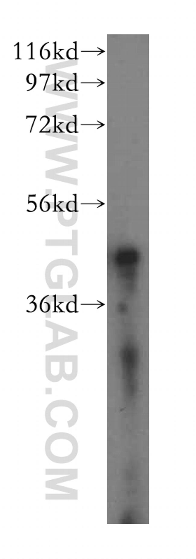 ACAT1 Antibody in Western Blot (WB)