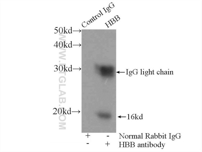 HBB Antibody in Immunoprecipitation (IP)