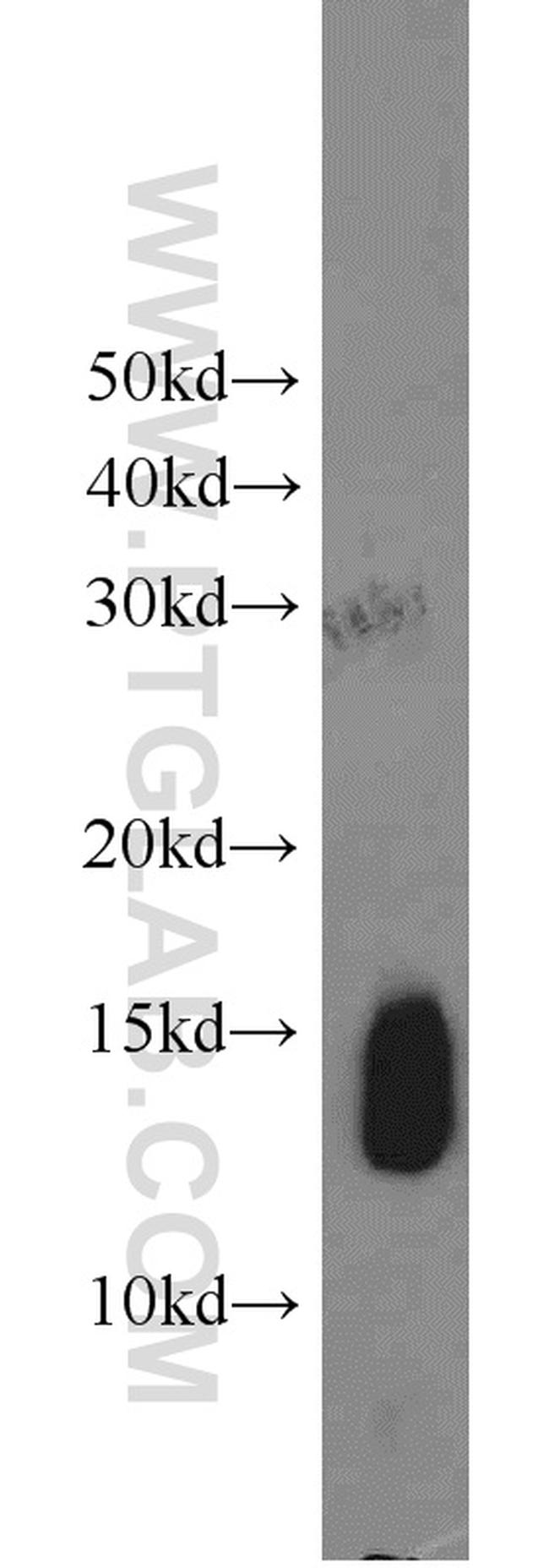 HBB Antibody in Western Blot (WB)