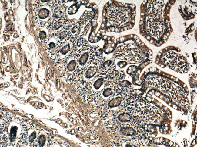 VPS39 Antibody in Immunohistochemistry (Paraffin) (IHC (P))