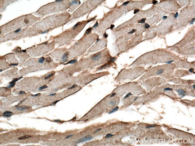 VPS39 Antibody in Immunohistochemistry (Paraffin) (IHC (P))