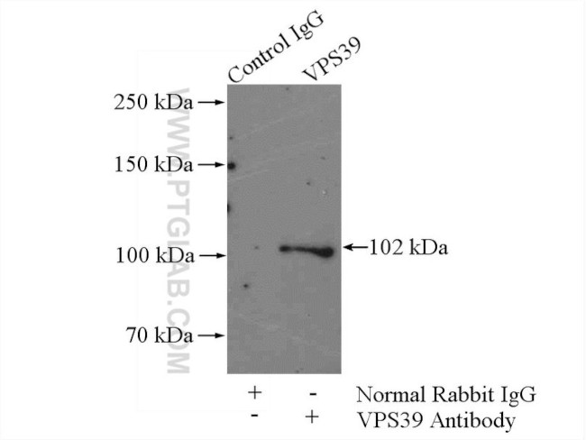 VPS39 Antibody in Immunoprecipitation (IP)