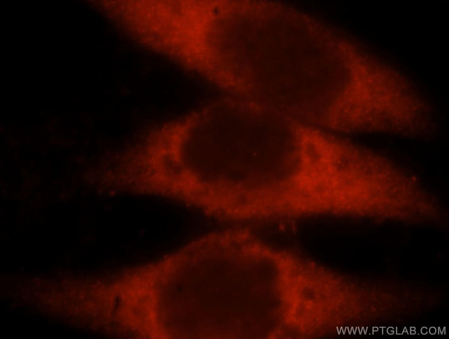 LDHAL6A Antibody in Immunocytochemistry (ICC/IF)