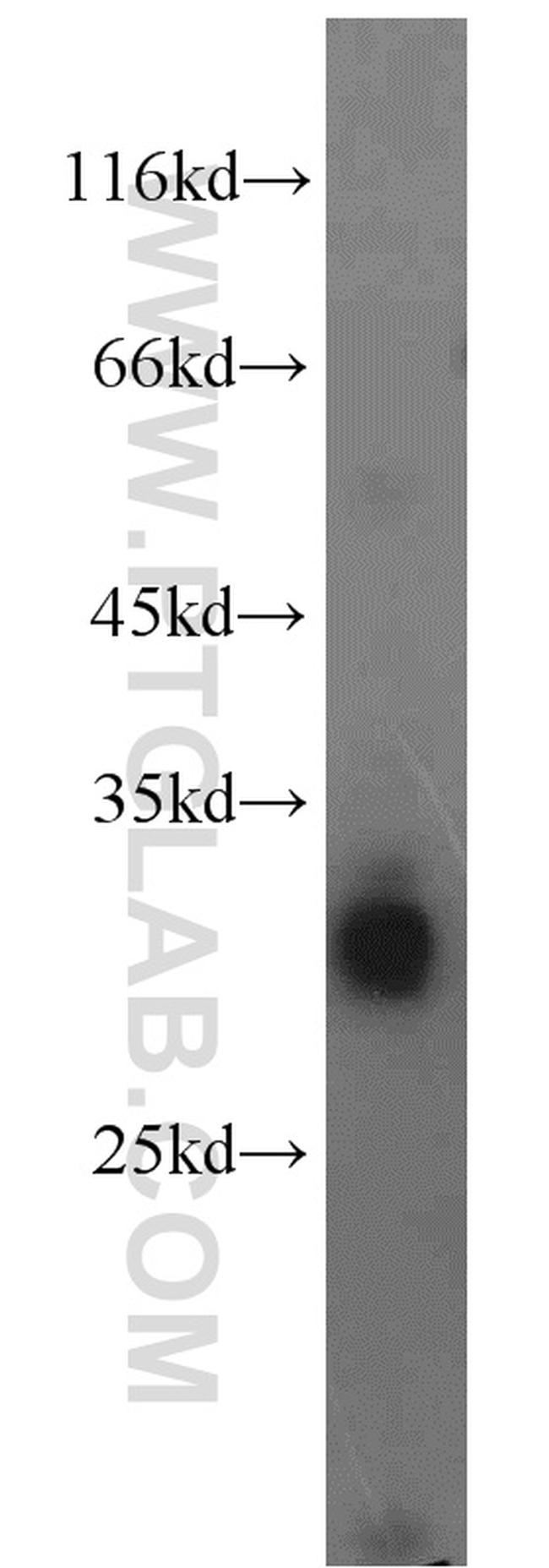 LDHAL6A Antibody in Western Blot (WB)